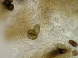 [Rinodina luridescens]