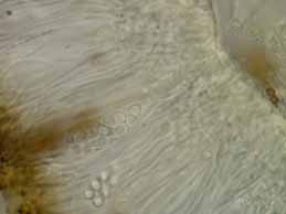 [Rinodina luridescens]