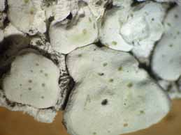 [Porpidinia tumidula]