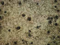 [Verrucaria calciseda]