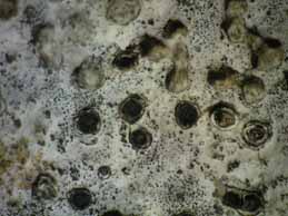 [Verrucaria hochstetteri]