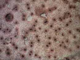 [Verrucaria marmorea]