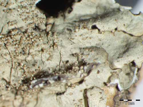 [Xanthoparmelia verrucigera]