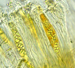 [C. marcescens]