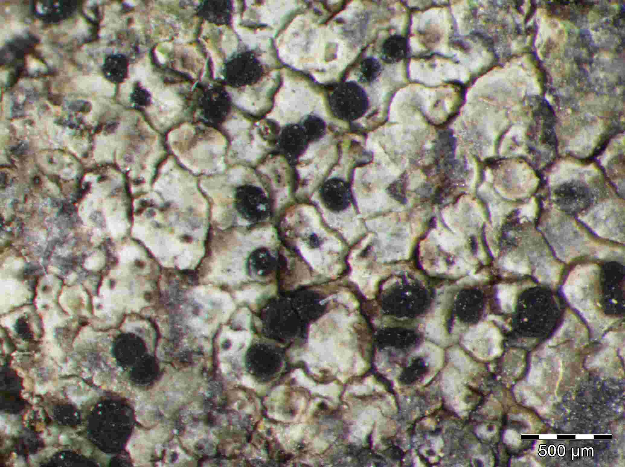 [Amandinea pelidna]
