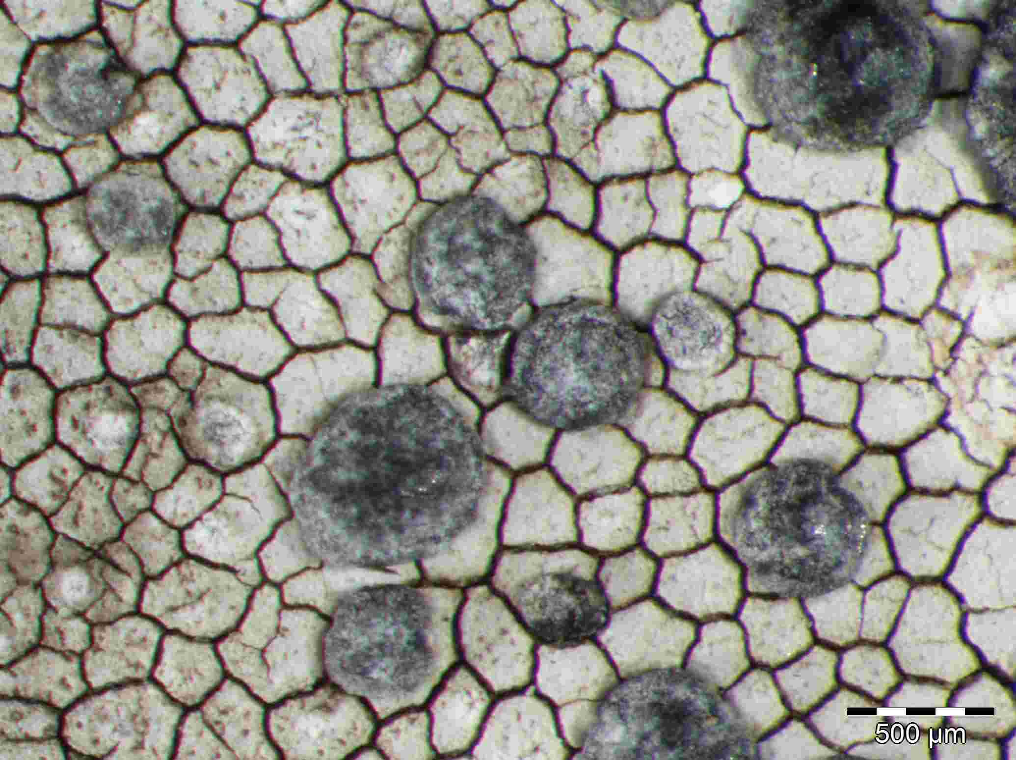 [Buellia tesserata]