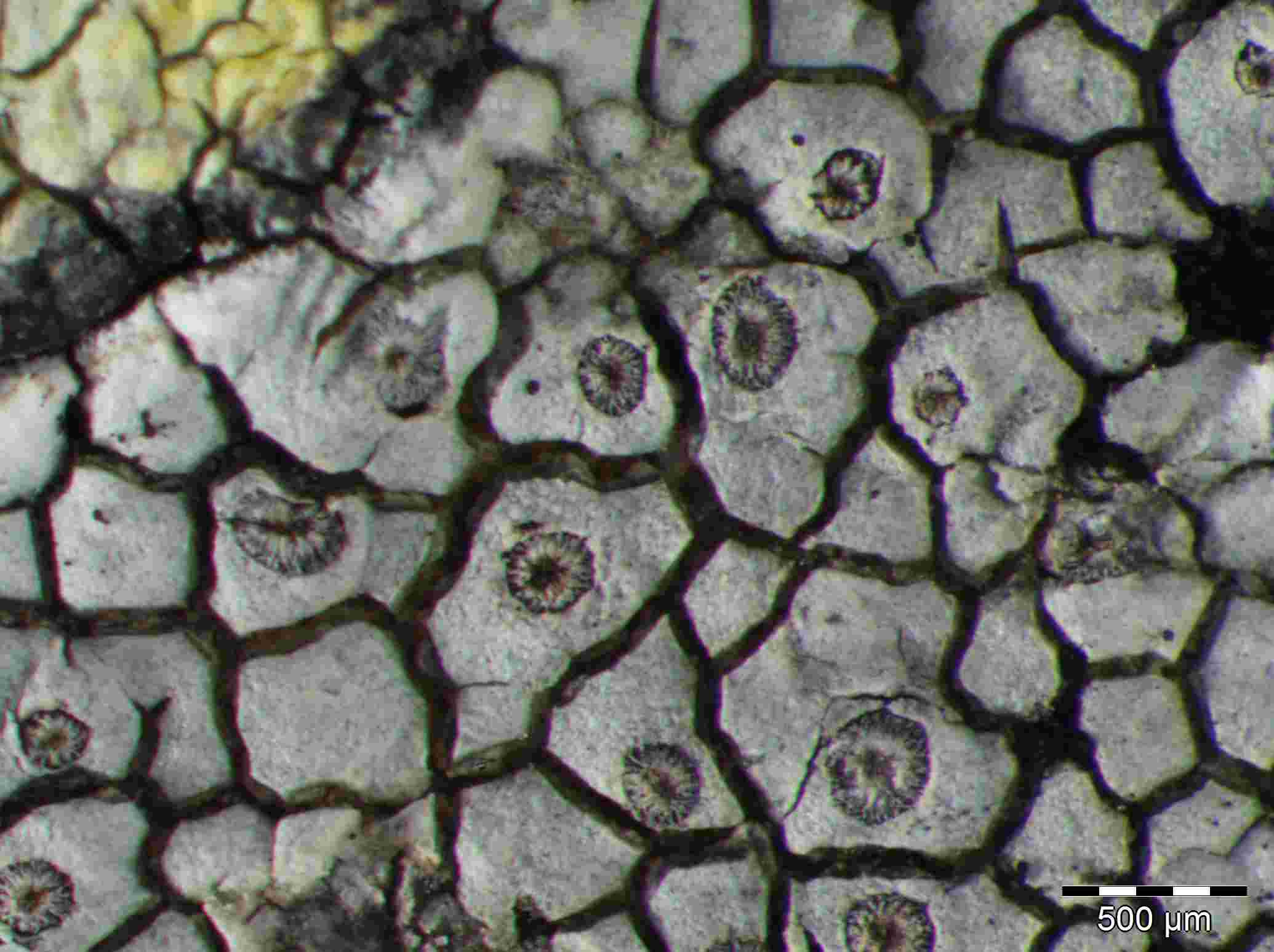 [Diploschistes actinostomus]