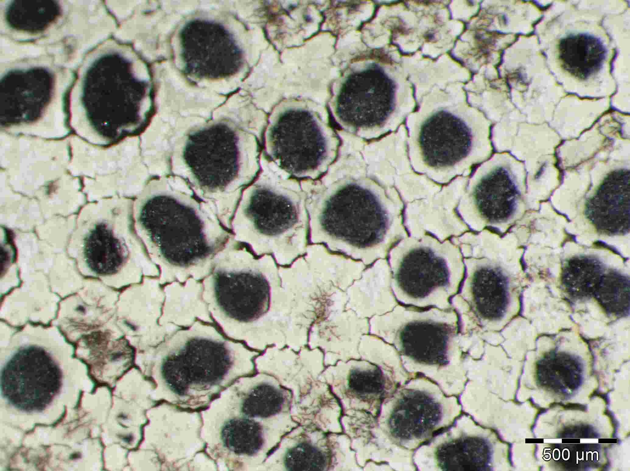 [Lecanora praepostera]
