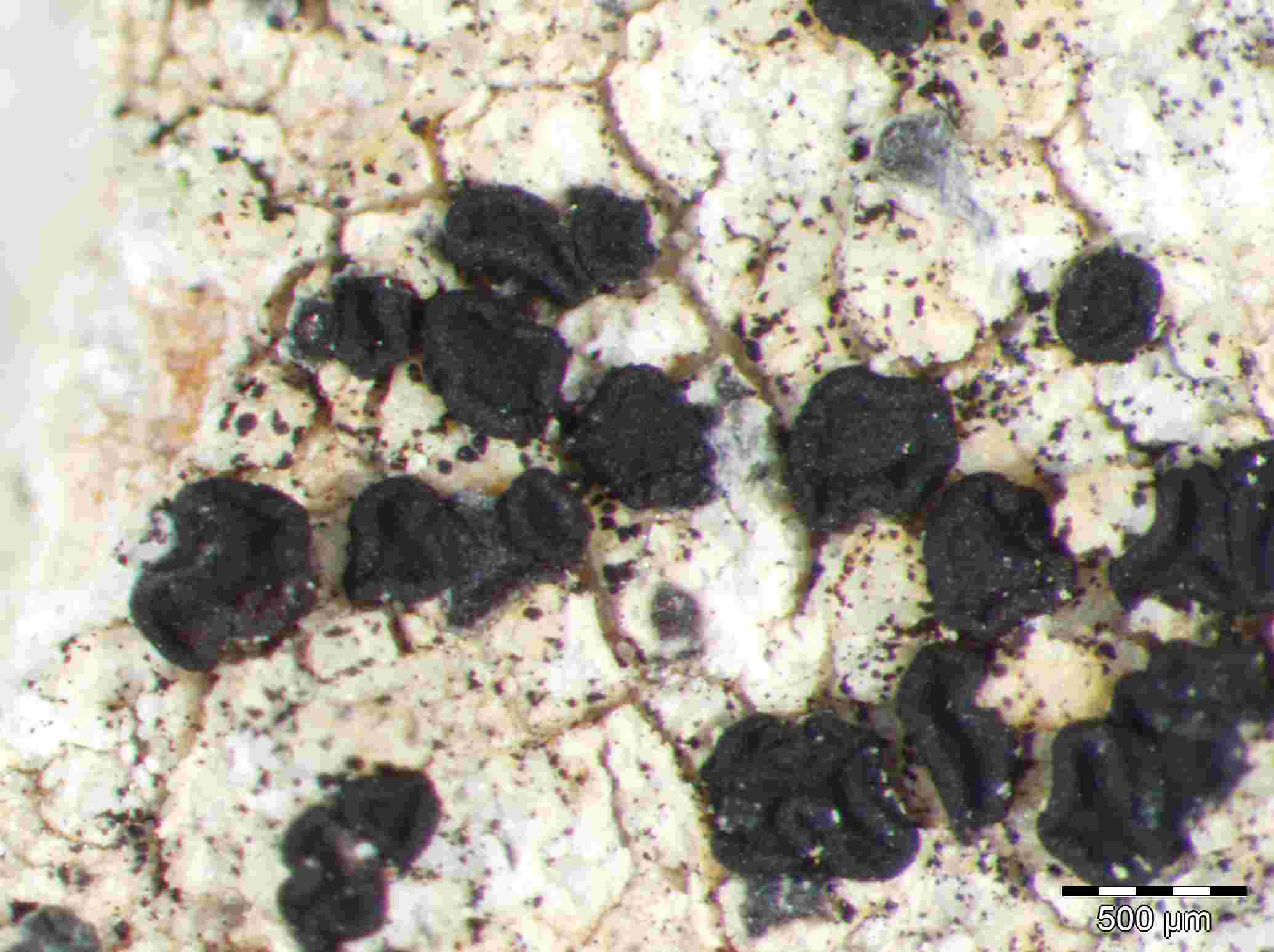 [Lecidea sarcogynoides]