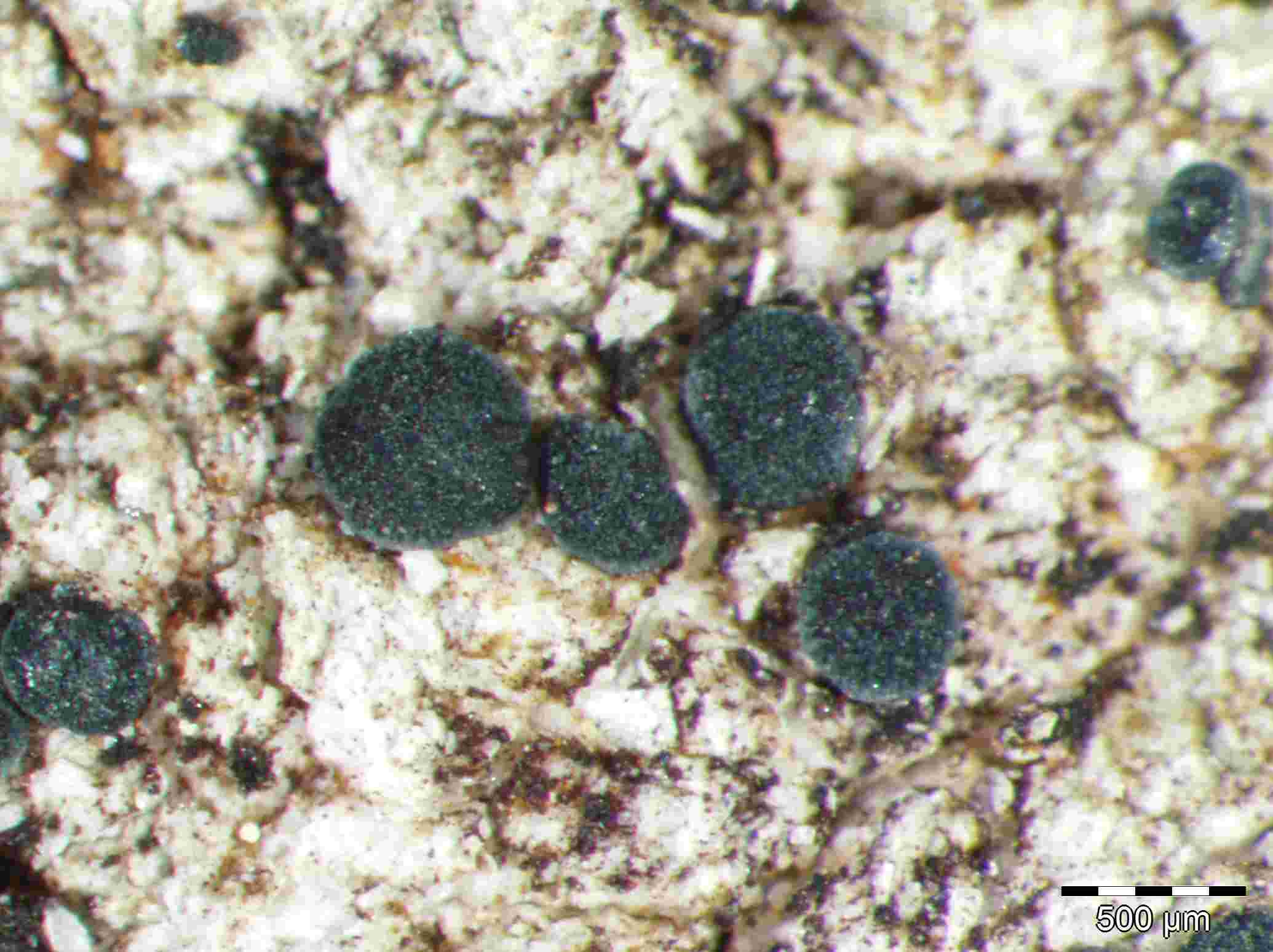 [Lecidella sp. B]