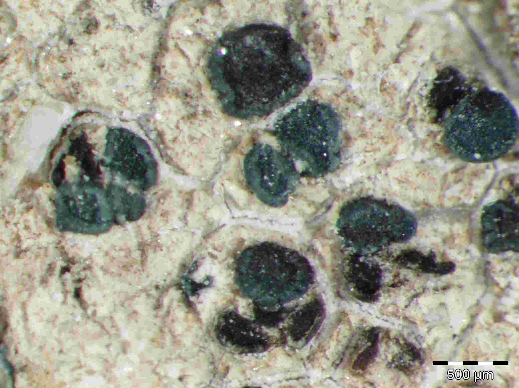 [Lecidella sp. B]