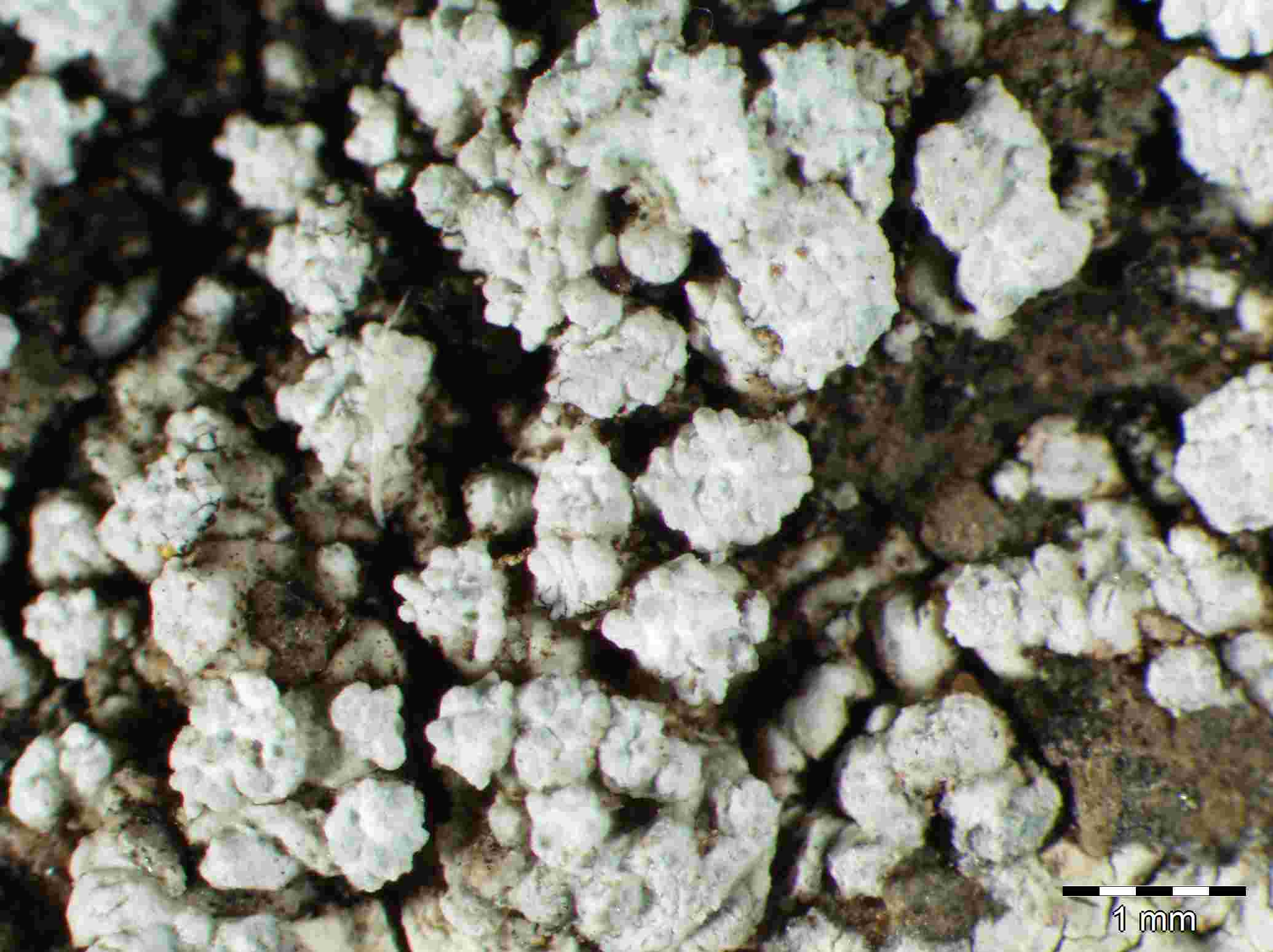 [Pertusaria amara]