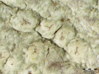 [Pertusaria heterochroa]
