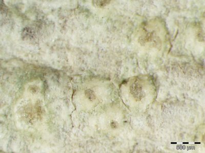 [Pertusaria heterochroa]