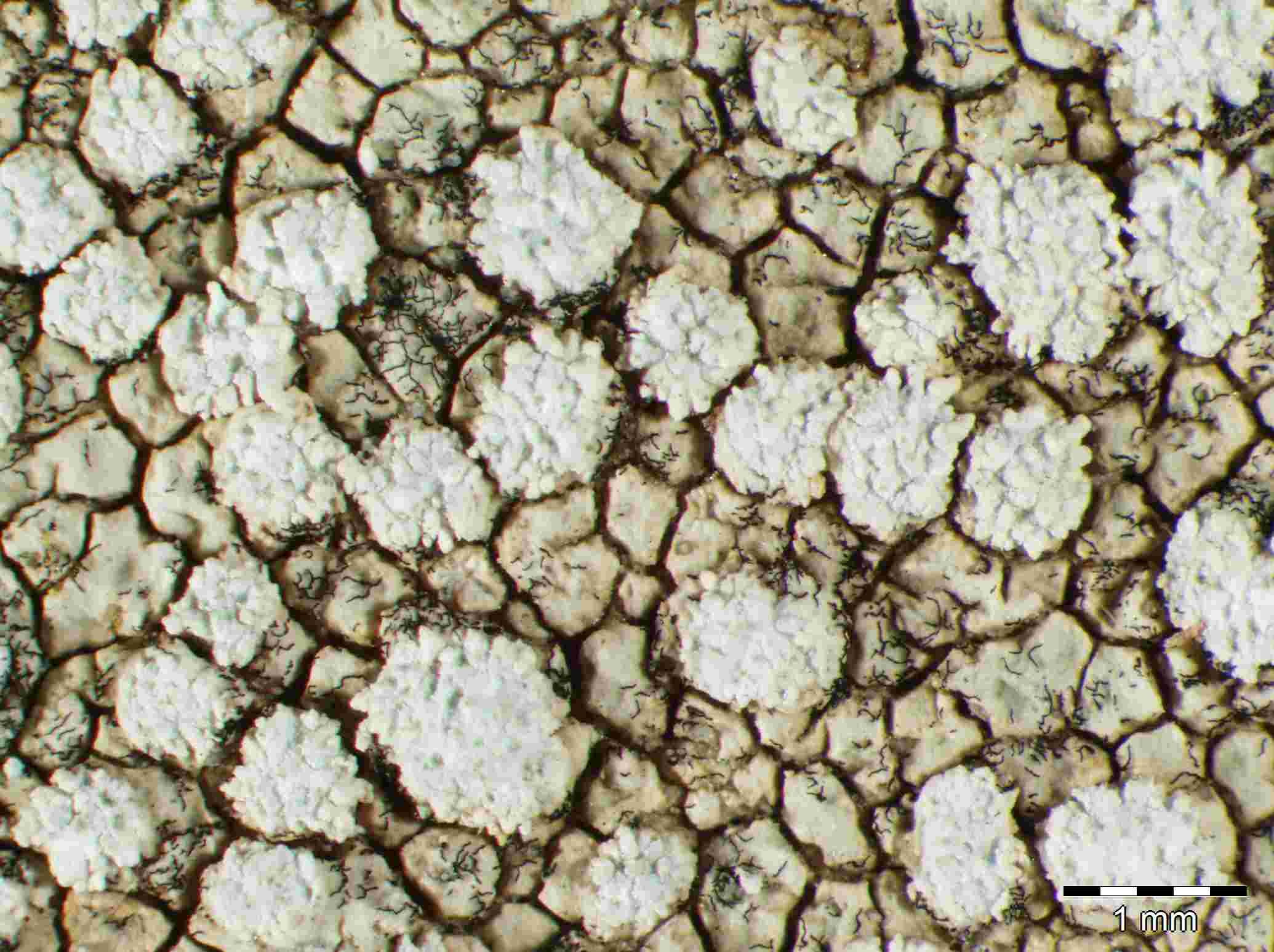 [Pertusaria teneriffensis]