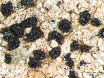 [Polysporina simplex]