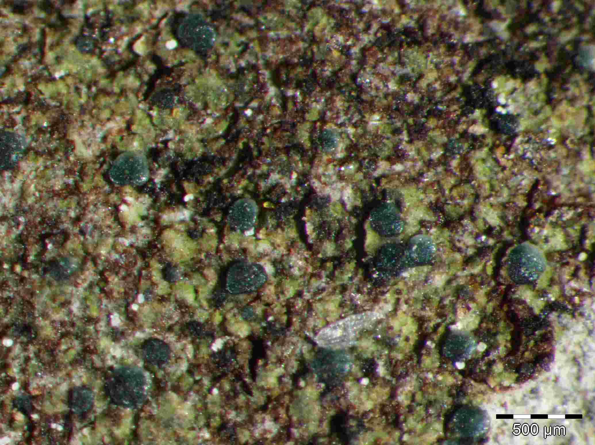 [Scoliciosporum umbrinum]