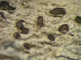 [Phaeographis scalpturata]