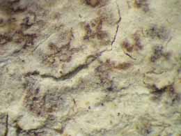 [Arthonia sp. A]