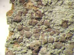 [Arthonia sp. B]