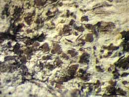 [Arthonia sp. B]
