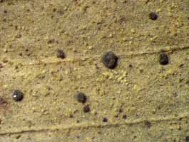 [Calopadia vermiculifera]