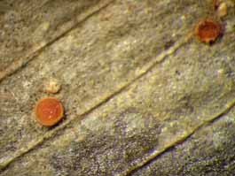 [Coenogonium sp.]