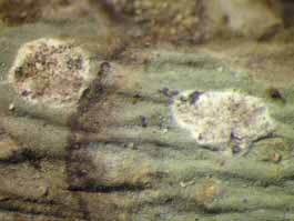 [Cryptothecia candida]