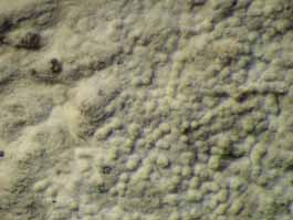 [Cryptothecia scripta]