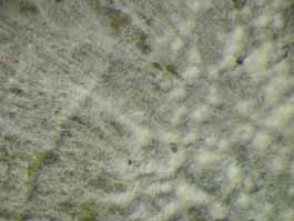 [Cryptothecia sp.]