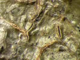 [Fissurina dumastii]
