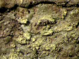 [Myeloconis erumpens]