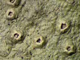 [Ocellularia feigei]