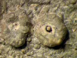 [Ocellularia interponenda]