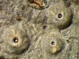[Ocellularia interponenda]
