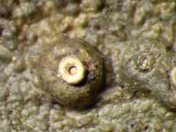 [Ocellularia massalongoi]