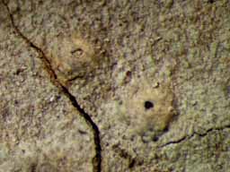 [Ocellularia orthomastia]