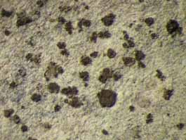 [Tylophoron sp.]