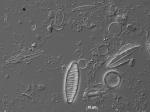 Eine Gewässerprobe der Lausitzer Neiße unter dem Lichtmikroskop: die Artenfülle von Kieselalgen wird deutlich. Ihre vielfältig gestalteten gläsernen Schalen aus Kieselsäure zeigen wichtige Bestimmungsmerkmale. © Forschungsgruppe Diatomeen, Botanischer Gar