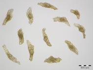 Samen vom Breitblättrigen Knabenkraut (Dactylorhiza majalis) Foto: M. Cubr, Botanischer Garten und Botanisches Museum Berlin